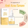 2_9cdf80df-5276-4ff0-851a-100807cde401 Anti Acne Face Serum 30 ml